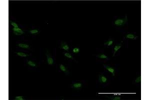 Immunofluorescence of monoclonal antibody to FOXM1 on HeLa cell. (FOXM1 anticorps  (AA 22-110))