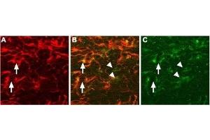 Expression of proNGF in rat brain sections - Immunohistochemical staining of proNGF in rat brain sections using Anti-proNGF Antibody (ABIN7043556, ABIN7044751 and ABIN7044752). (Nerve Growth Factor anticorps  (Pro-Domain))