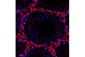 Immunofluorescence of paraffin embedded mouse testis using smad62024 (ABIN7075629) at dilution of 1:1000 (300x lens)