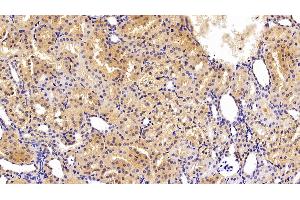 Detection of TF in Porcine Kidney Tissue using Polyclonal Antibody to Transferrin (TF) (Transferrin anticorps  (AA 361-683))
