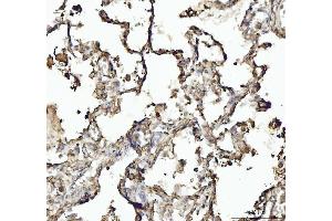IHC analysis of Annexin VI/ANXA6 using anti-Annexin VI/ANXA6 antibody (ABIN5692982).