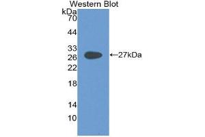 Western Blotting (WB) image for anti-Glycoprotein 2 (Zymogen Granule Membrane) (GP2) (AA 307-512) antibody (ABIN2118694) (GP2 anticorps  (AA 307-512))