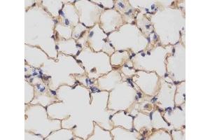 IHC testing of FFPE mouse lung tissue with Csf1r antibody at 1:25 dilution. (CSF1R anticorps  (AA 895-923))