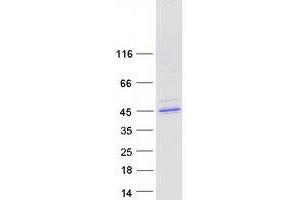 Validation with Western Blot