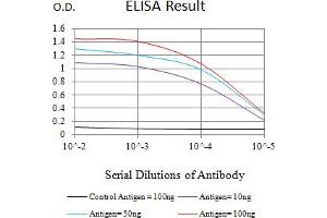 Black line: Control Antigen (100 ng),Purple line: Antigen (10 ng), Blue line: Antigen (50 ng), Red line:Antigen (100 ng)