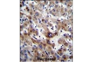 SLC25A6 Antibody (Center) (ABIN656122 and ABIN2845461) immunohistochemistry analysis in formalin fixed and paraffin embedded human liver tissue followed by peroxidase conjugation of the secondary antibody and DAB staining.