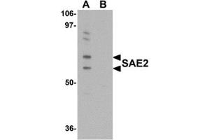 Western blot analysis of SAE2 in 293 cell lysate with SAE2 antibody at 0. (UBA2 anticorps  (C-Term))