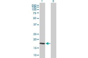 Western Blot analysis of MRAP expression in transfected 293T cell line by MRAP MaxPab polyclonal antibody.