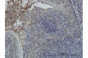 Immunoperoxidase of monoclonal antibody to RPS6KA6 on formalin-fixed paraffin-embedded human tonsil. (RPS6KA6 anticorps  (AA 636-745))