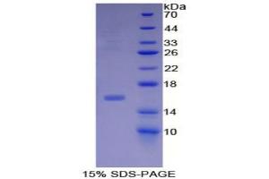 SDS-PAGE analysis of Human Inhibin beta B Protein. (INHBB Protéine)