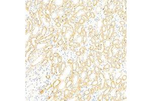 Immunohistochemistry analysis of paraffin-embedded rat kidney using GBA (ABIN7074062) at dilution of 1: 2000 (GBA anticorps)