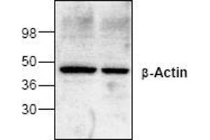 Image no. 1 for anti-Actin, beta (ACTB) antibody (ABIN127292) (beta Actin anticorps)