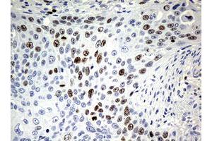 Image no. 1 for anti-Antigen Identified By Monoclonal Antibody Ki-67 (MKI67) (AA 1160-1493) antibody (ABIN1490857) (Ki-67 anticorps  (AA 1160-1493))