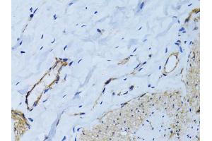 Immunohistochemistry of paraffin-embedded human colon using MCAM antibody (ABIN6290150) at dilution of 1:100 (40x lens). (MCAM anticorps)