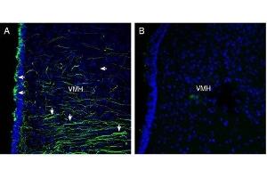 Expression of Semaphorin 4A in rat hypothalamus - Immunohistochemical staining of perfusion-fixed frozen rat brain sections with Anti-Semaphorin 4A (SEMA4A) (extracellular) Antibody (ABIN7043610, ABIN7045300 and ABIN7045301), (1:300), followed by goat anti-rabbit-Alexa-488. (Sema4a anticorps  (Extracellular, N-Term))