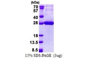 SDS-PAGE (SDS) image for Carcinoembryonic Antigen-Related Cell Adhesion Molecule 21 (CEACAM21) (AA 35-240) protein (His tag) (ABIN5853147)