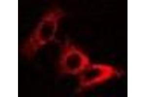 Immunofluorescent analysis of Pyridoxal Kinase staining in U2OS cells.