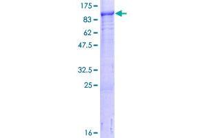 Image no. 1 for LIM and Cysteine-Rich Domains 1 (LMCD1) (AA 1-365) protein (GST tag) (ABIN1309501)
