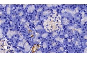 Detection of CK5 in Rat Pancreas Tissue using Polyclonal Antibody to Cytokeratin 5 (CK5)