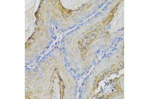 Immunohistochemistry of paraffin-embedded mouse stomach using CALML5 antibody (ABIN5974468) at dilution of 1/100 (40x lens). (CALML5 anticorps)