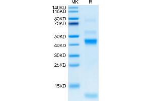 Latent TGF-beta 1 (AA 30-390) protein (His tag)