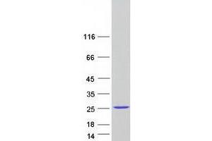 Validation with Western Blot