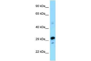 WB Suggested Anti-Nrbf2 Antibody Titration: 1. (NRBF2 anticorps  (N-Term))