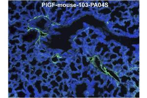 Immunofluorescence staining (green) of mouse lung tissue (ED18) with anti-Mouse PlGF Antibody Cat. (PLGF anticorps  (AA 24-158))