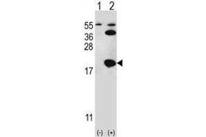 Western blot analysis of UBE2I antibody and 293 cell lysate either nontransfected (Lane 1) or transiently transfected (2) with the UBE2I gene.