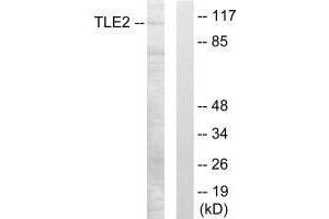 Western blot analysis of extracts from LOVO cells, using TLE2 antibody. (TLE2 anticorps)