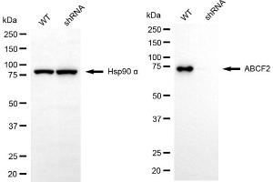 Western blotting analysis using ABCF2 antibody (ABIN7797690).