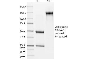 SDS-PAGE Analysis Purified Cytokeratin 15 Mouse Monoclonal Antibody (KRT15/2957).