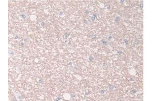 Detection of BCAR1 in Human Cerebrum Tissue using Polyclonal Antibody to Breast Cancer Anti-Estrogen Resistance 1 (BCAR1)