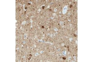 Immunohistochemical staining (Formalin-fixed paraffin-embedded sections) of human cerebral cortex with NECAB1 monoclonal antibody, clone CL0576  shows immunoreactivity in a subset of neuronal cells. (NECAB1 anticorps)