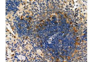 ABIN6261515 and ABIN6278456 at 1/100 staining Rat spleen tissue by IHC-P.