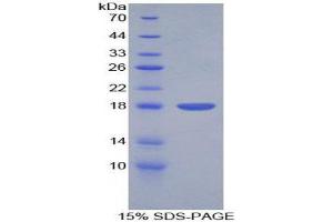 SDS-PAGE (SDS) image for PDGF-BB Homodimer (AA 82-190) protein (His tag) (ABIN1980800) (PDGF-BB Homodimer (AA 82-190) protein (His tag))