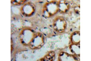 IHC-P analysis of Adrenal tissue, with DAB staining. (ADCY1 anticorps  (AA 835-1061))