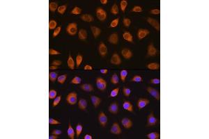 Immunofluorescence analysis of L929 cells using SEL1L antibody (ABIN6132642, ABIN6147499, ABIN6147500 and ABIN6215644) at dilution of 1:100. (SEL1L anticorps  (AA 22-190))