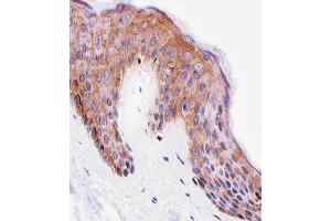 Immunohistochemical analysis of paraffin-embedded H.