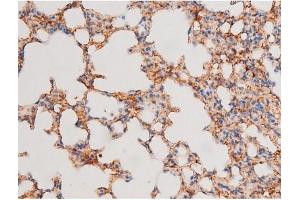 ABIN6267526 at 1/200 staining Mouse lung tissue sections by IHC-P.