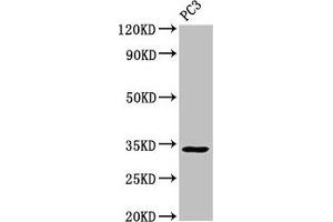 Western Blot Positive WB detected in: PC-3 whole cell lysate All lanes: STX1A antibody at 3 μg/mL Secondary Goat polyclonal to rabbit IgG at 1/50000 dilution Predicted band size: 34, 30, 29 kDa Observed band size: 34 kDa (STX1A anticorps  (AA 1-265))