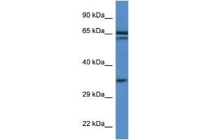 WB Suggested Anti-Terf2ip Antibody Titration: 1. (RAP1 anticorps  (Middle Region))