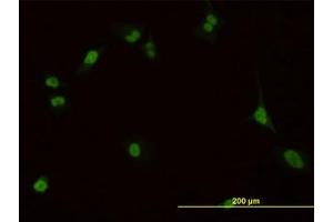 Image no. 3 for anti-Pre-B-Cell Leukemia Homeobox Protein 1 (PBX1) (AA 213-322) antibody (ABIN598855) (PBX1 anticorps  (AA 213-322))