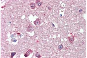 Brain, cortex, Human: Formalin-Fixed, Paraffin-Embedded (FFPE)