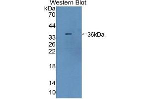 Western blot analysis of the recombinant protein. (TLR8 anticorps  (AA 519-812))