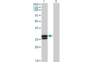 Western Blot analysis of OSM expression in transfected 293T cell line by OSM MaxPab polyclonal antibody. (Oncostatin M anticorps  (AA 1-252))