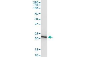 Immunoprecipitation of COMT transfected lysate using anti-COMT MaxPab rabbit polyclonal antibody and Protein A Magnetic Bead , and immunoblotted with COMT purified MaxPab mouse polyclonal antibody (B01P) .