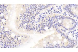 Detection of NTRK3 in Human Small intestine Tissue using Polyclonal Antibody to Neurotrophic Tyrosine Kinase Receptor Type 3 (NTRK3)