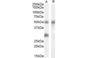 Western Blotting (WB) image for anti-Dual Specificity Phosphatase 11 (RNA/RNP Complex 1-Interacting) (DUSP11) (Middle Region) antibody (ABIN2778853) (DUSP11 anticorps  (Middle Region))