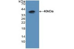 Western blot analysis of recombinant Human NFkB. (NFkB anticorps  (AA 805-892))